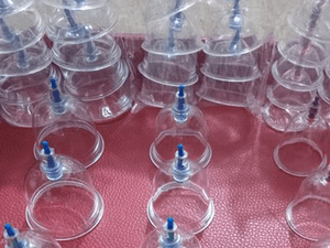 Medical cupping cups